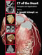 CT of the Heart - Principles and Applications