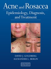 Acne and Rosacea - Epidemiology, Diagnosis and Treatment